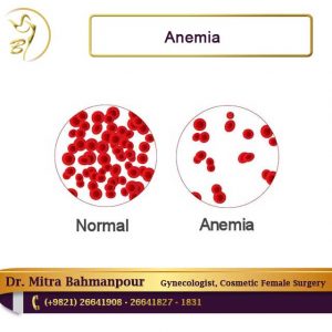 anemia