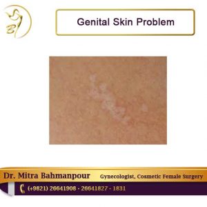 genital skin problem