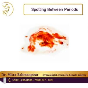 Spotting Before Period or Between Periods: Causes