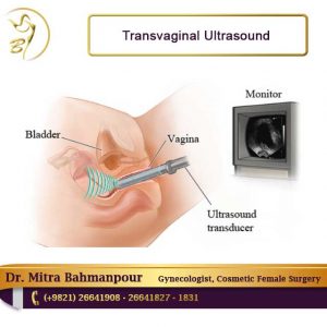 transvaginal ultrasound