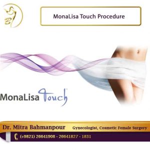 MonaLisa touch procedure